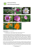 rodzina Asteraceae (Astrowate) - Miejski Ogród Botaniczny w Zabrzu